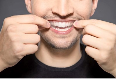 Tiras blanqueadoras dentales